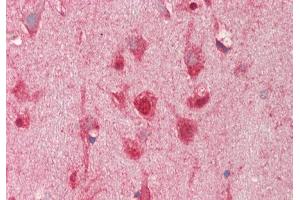 Immunohistochemistry (IHC) image for anti-Anoctamin 10 (ANO10) (C-Term) antibody (ABIN2782940)