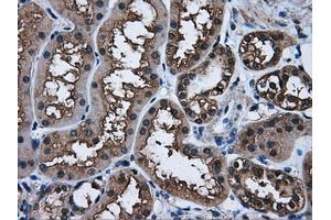 Immunohistochemical staining of paraffin-embedded Kidney tissue using anti-AKR1A1mouse monoclonal antibody. (AKR1A1 Antikörper)