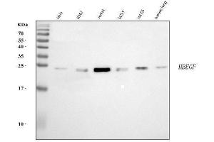 Western blot analysis of DTR/HBEGF using anti-DTR/HBEGF antibody (ABIN7603042).