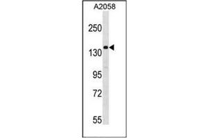 Western blot analysis of anti-ULK1 Antibody  in A2058 cell lysate. (ULK1 Antikörper  (AA 649-679))