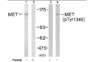 Image no. 1 for anti-Met Proto-Oncogene (MET) (pTyr1349) antibody (ABIN196990) (c-MET Antikörper  (pTyr1349))