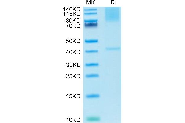 Glypican 3 Protein (GPC3) (AA 25-559) (His tag)