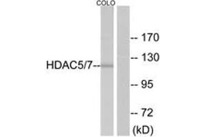 Western Blotting (WB) image for anti-Histone Deacetylase 5 (HDAC5) (AA 464-513) antibody (ABIN2888998) (HDAC5 Antikörper  (AA 464-513))