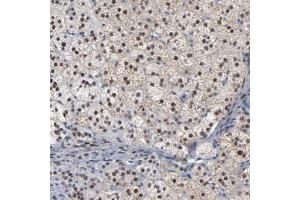Immunohistochemical staining of human adrenal gland with FOXN2 polyclonal antibody  shows nuclear positivity in cortical cells at 1:50-1:200 dilution. (FOXN2 Antikörper)