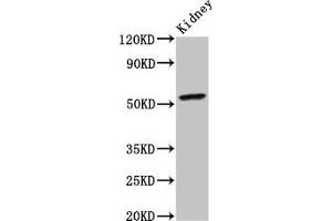 Western Blot Positive WB detected in: Mouse kidney tissue All lanes: CYP2C19 antibody at 4 μg/mL Secondary Goat polyclonal to rabbit IgG at 1/50000 dilution Predicted band size: 56 kDa Observed band size: 56 kDa (CYP2C19 Antikörper  (AA 245-353))