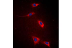 Immunofluorescent analysis of FATP5 staining in HeLa cells. (SLC27A5 Antikörper  (Center))