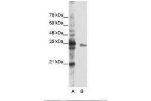 Image no. 2 for anti-Exosome Component 3 (EXOSC3) (AA 81-130) antibody (ABIN6736236) (EXOSC3 Antikörper  (AA 81-130))