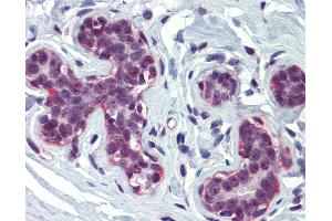Anti-CREBBP antibody IHC of human breast. (CBP Antikörper  (AA 144-193))