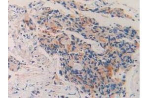 IHC-P analysis of Human Prostate Gland Tissue, with DAB staining. (MME Antikörper  (AA 382-538))
