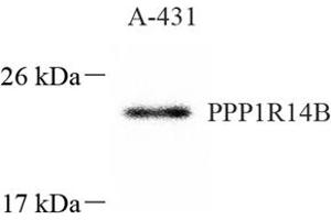 Western blot analysis of PNG (ABIN7075269),at dilution of 1: 1000 (PPP1R14B Antikörper)