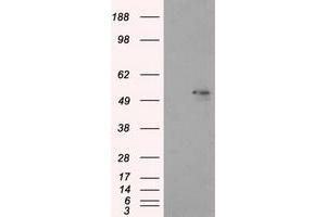 Image no. 6 for anti-Aldehyde Dehydrogenase 3 Family, Member A1 (ALDH3A1) antibody (ABIN1496591) (ALDH3A1 Antikörper)