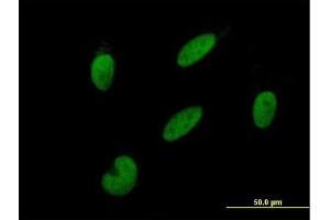 Immunofluorescence of purified MaxPab antibody to GTF2A2 on HepG2 cell. (GTF2A2 Antikörper  (AA 1-109))