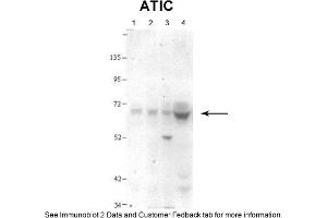 Sample Type: 1. (ATIC Antikörper  (N-Term))