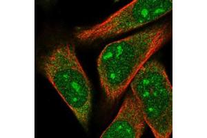 Immunofluorescent staining of RH-30 cells with ARPP-21 polyclonal antibody  (Green) shows localization to nucleoli and cytosol. (ARPP21 Antikörper)