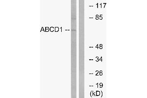 Western blot analysis of extracts from Jurkat cells, using ABCD1 antibody. (ABCD1 Antikörper)