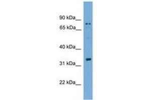 Image no. 1 for anti-Sperm Acrosome Associated 1 (SPACA1) (AA 51-100) antibody (ABIN6745571) (SPACA1 Antikörper  (AA 51-100))