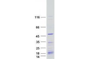 Validation with Western Blot