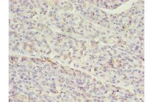 Immunohistochemistry of paraffin-embedded human pancreatic tissue using ABIN7155517 at dilution of 1:100 (SETD7 Antikörper  (AA 1-218))