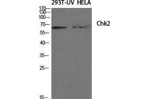 Western Blotting (WB) image for anti-Checkpoint Kinase 2 (CHEK2) (Tyr60) antibody (ABIN6280208)