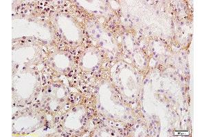 Formalin-fixed and paraffin embedded human kidney labeled with Rabbit Anti-PDGFBB Polyclonal Antibody, Unconjugated  at 1:200 followed by conjugation to the secondary antibody and DAB staining (PDGF-BB Homodimer (AA 151-241) Antikörper)