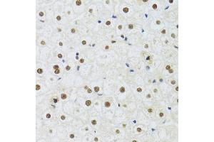 Immunohistochemistry of paraffin-embedded human liver using DDB1 Antibody (ABIN5971498) at dilution of 1/100 (40x lens).