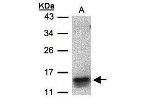 Western blot analysis of 30 ug of whole cell lysate (A:MOLT4) using a 15 % SDS PAGE gel and I309 antibody at a dilution of 1:500 (CCL1 Antikörper)