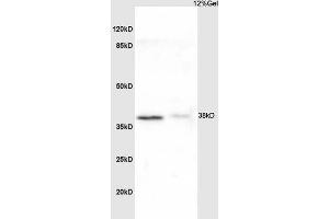 L1 rat liver lysate L2 mouse kidney lysates probed with Anti NDUFA8 Polyclonal Antibody, Unconjugated (ABIN751723) at 1:200 overnight at 4 °C. (NDUFA8 Antikörper  (AA 101-172))
