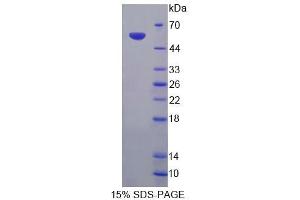 SDS-PAGE (SDS) image for Tenascin R (Restrictin, Janusin) (TNR) (AA 329-588) protein (His tag,GST tag) (ABIN6239151)