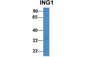 Host:  Rabbit  Target Name:  ING1  Sample Type:  Human 721_B  Antibody Dilution:  1. (ING1 Antikörper  (N-Term))