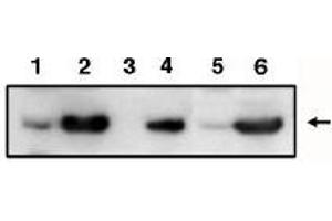 Image no. 1 for anti-Tumor Protein P53 Inducible Protein 3 (TP53I3) antibody (ABIN265005) (TP53I3 Antikörper)