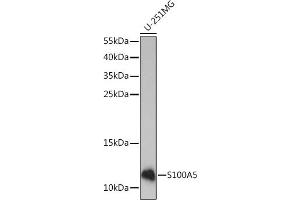 Western blot analysis of extracts of U-251MG cells, using S100 Rabbit pAb (ABIN7270126) at 1:1000 dilution.