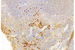 ABIN6261731 and ABIN6269136 at 1/100 staining Mouse spleen tissue by IHC-P. (FGFR1 Antikörper  (C-Term))