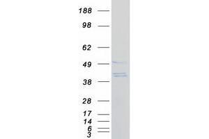 Western Blotting (WB) image for SAC3 Domain Containing 1 (SAC3D1) protein (Myc-DYKDDDDK Tag) (ABIN2731348)