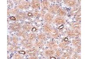 Immunohistochemistry (IHC) image for anti-Notum Pectinacetylesterase Homolog (NOTUM) (N-Term) antibody (ABIN1031488) (NOTUM Antikörper  (N-Term))