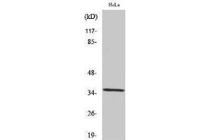Western Blotting (WB) image for anti-Zinc Finger Protein 265 (Zranb2) (Internal Region) antibody (ABIN3187540) (ZNF265 Antikörper  (Internal Region))