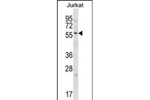 GPC3 Antibody  (cat (ABIN652202 and ABIN2840751)) western blot analysis in Jurkat cell line lysates (35 μg/lane). (Glypican 3 Antikörper  (C-Term))