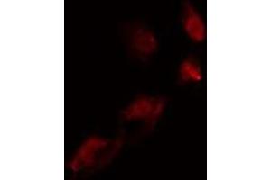 ABIN6275542 staining  COLO205 cells by IF/ICC. (TLK2 Antikörper  (Internal Region))