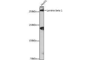 Western blot analysis of extracts of HepG2 cells, using Laminin beta 1 Rabbit mAb (ABIN7268185) at 1:1000 dilution. (Laminin beta 1 Antikörper)