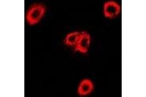Immunofluorescent analysis of OXA1L staining in U2OS cells. (OXA1L Antikörper)
