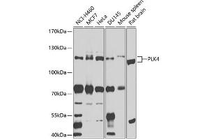 Western blot analysis of extracts of various cell lines, using PLK4 antibody (ABIN6132496, ABIN6145781, ABIN6145782 and ABIN6225196) at 1:1000 dilution. (PLK4 Antikörper  (AA 641-970))