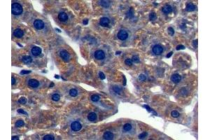DAB staining on IHC-P; Samples: Rat Liver Tissue (LSS Antikörper  (AA 101-250))