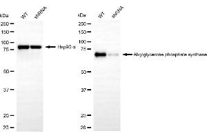 Western blotting analysis using alkylglycerone phosphate synthase antibody (ABIN7797582). (Rekombinanter AGPS Antikörper)