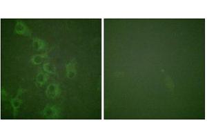 Immunofluorescence analysis of HuvEc cells, using Histamine H1 Receptor (Phospho-Ser398) antibody. (HRH1 Antikörper  (pSer398))