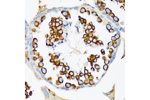 Immunohistochemistry (IHC) image for anti-Calmegin (CLGN) antibody (ABIN7266026)