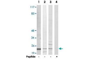 Western blot analysis of extracts from Jurkat cells (Lane 1 and lane 4), K-562 cells (Lane 2) and HUVEC cells (Lane 3), using AKAP14 polyclonal antibody . (AKAP14 Antikörper)