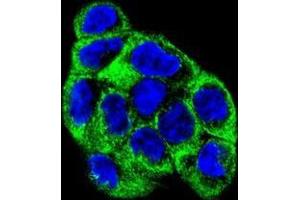 Immunofluorescence (IF) image for anti-ATPase, H+ Transporting, Lysosomal 56/58kDa, V1 Subunit B1 (ATP6V1B1) (AA 291-318), (Middle Region) antibody (ABIN950569)