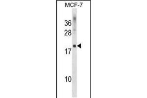 Western blot analysis in MCF-7 cell line lysates (35ug/lane). (CMTM5 Antikörper  (AA 62-88))
