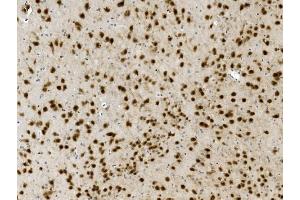 IHC analysis of NOVA2 using anti-NOVA2 antibody (ABIN7599078).