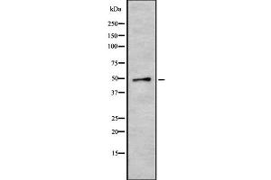 Western blot analysis of CRLF3 using HeLa whole cell lysates (CRLF3 Antikörper  (Internal Region))