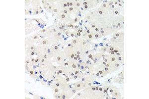 Immunohistochemistry of paraffin-embedded human stomach using HMGN1 antibody. (HMGN1 Antikörper  (AA 1-100))